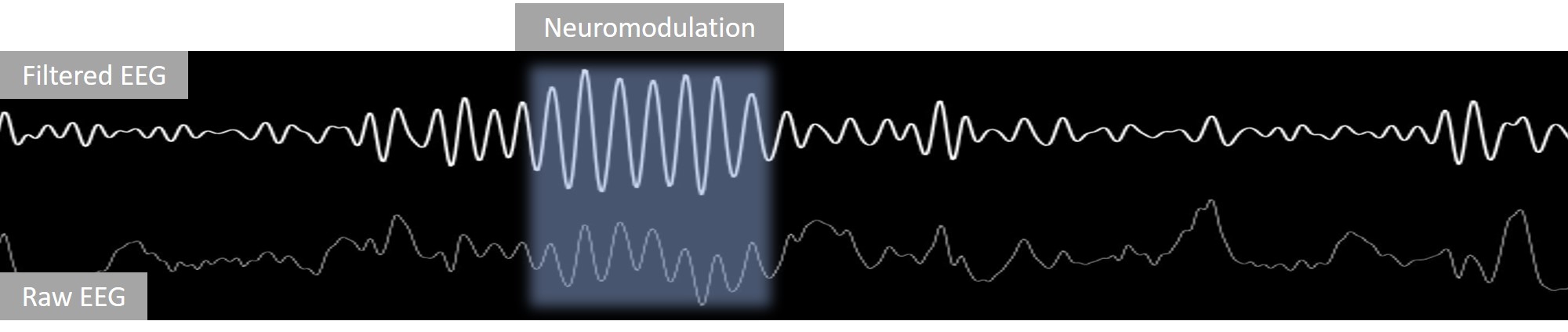 neuromodulations