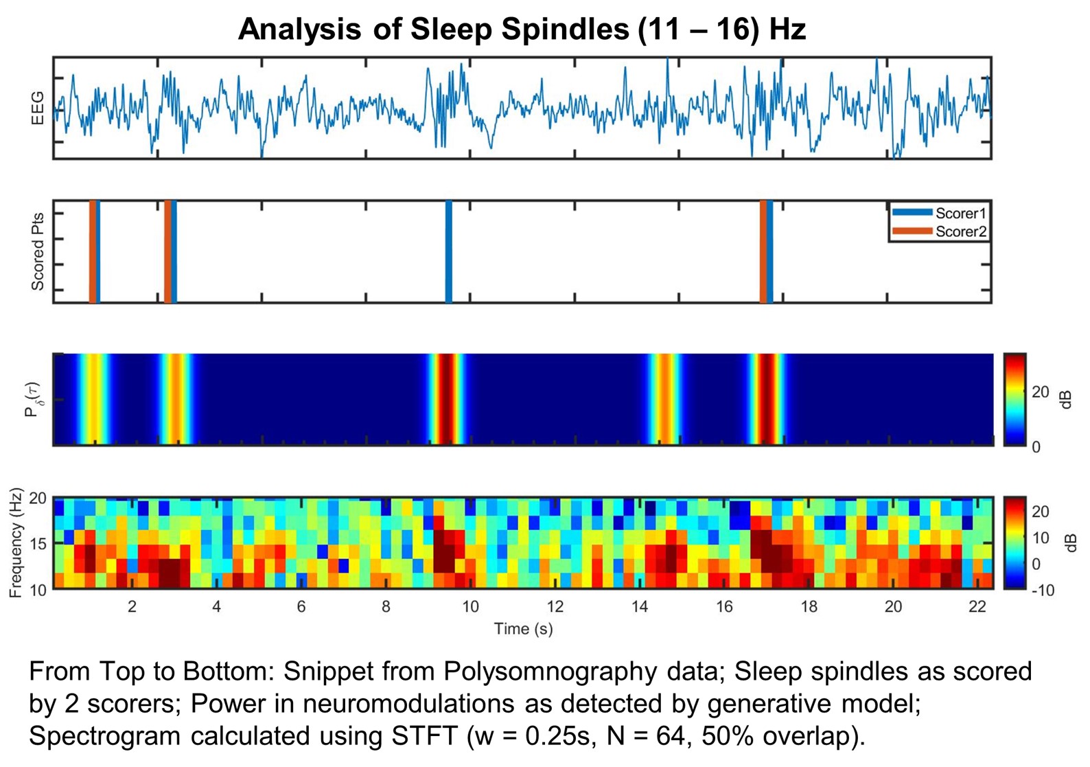 Sleep Analysis